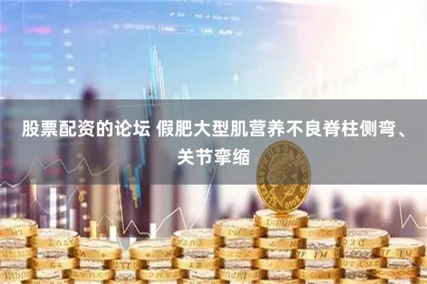 股票配资的论坛 假肥大型肌营养不良脊柱侧弯、关节挛缩